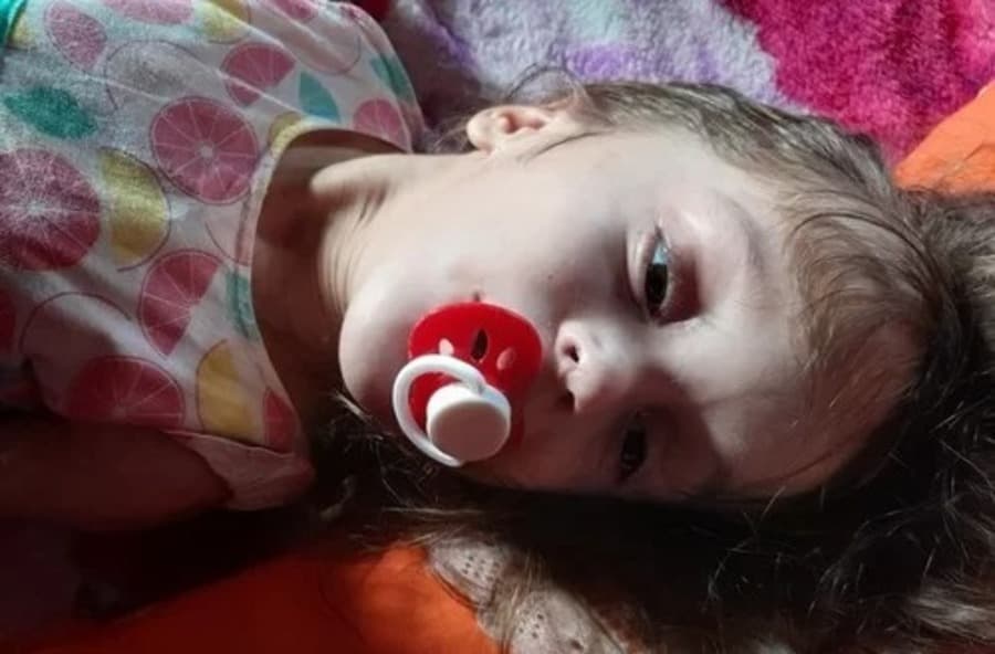 Mãe cria vaquinha online em prol da filha diagnosticada com hidranencefalia