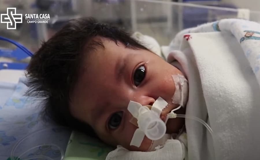 Comunidade de Maracaju se une para arrecadar R$ 30 mil a bebê que precisa de cirurgia