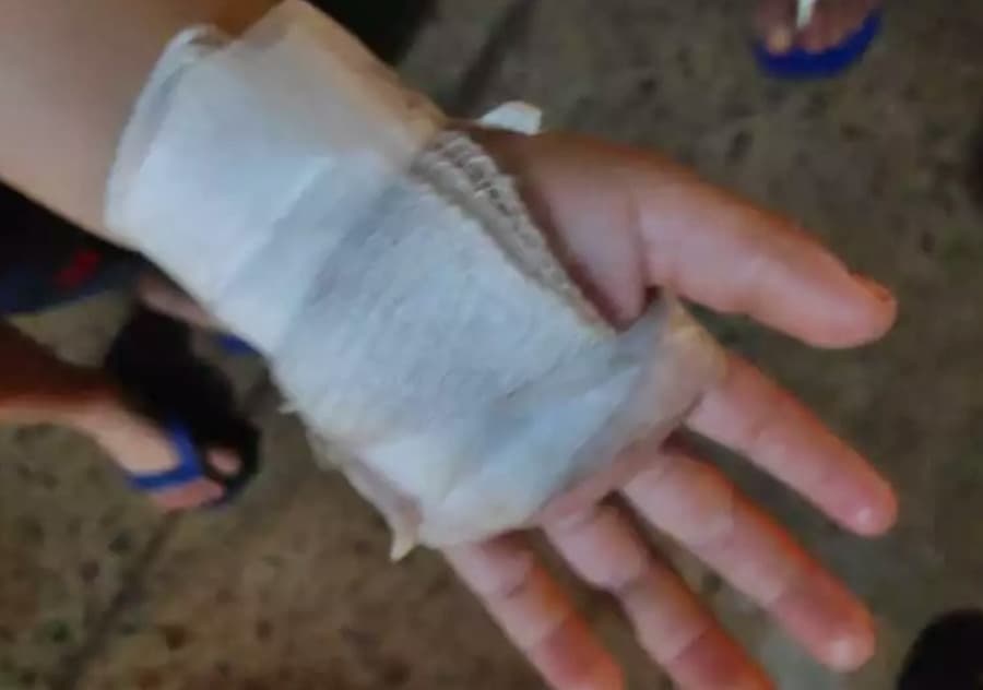 Morador do Eldorado, menino de 3 anos diz que foi ferido com faca pelo padrasto