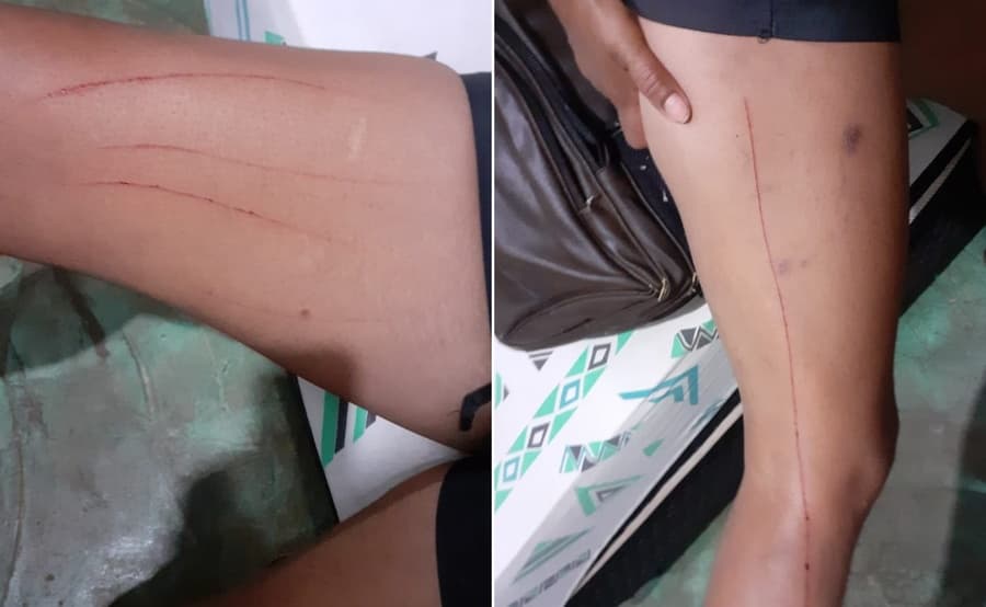 Socorrida por vereador e familiares, mulher deixa fazenda onde sofreu ameaças do marido