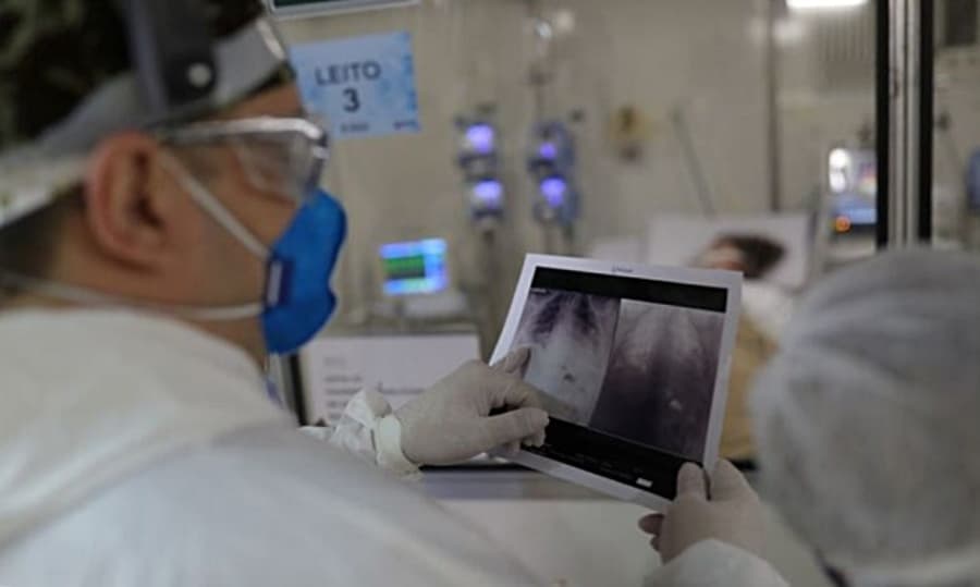 Maracaju e Sidrolândia apresentam alto número de casos de síndrome respiratória aguda grave