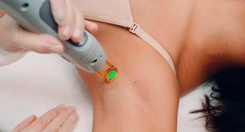 Spazen promove dia especial de depilação a laser neste sábado em Sidrolândia