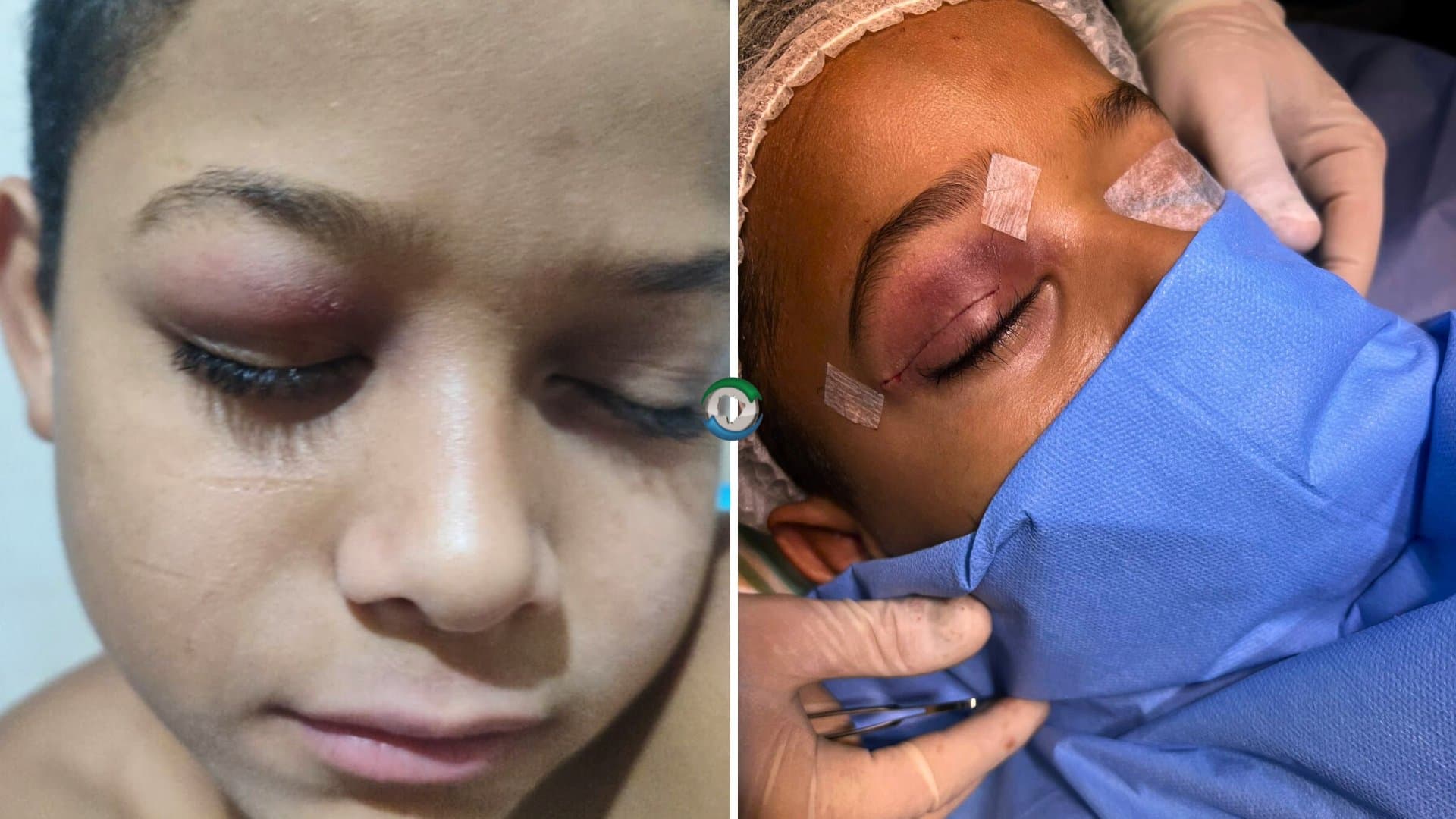 Mãe sidrolandense comemora cirurgia do filho de 11 anos após apoio da prefeitura e da comunidade