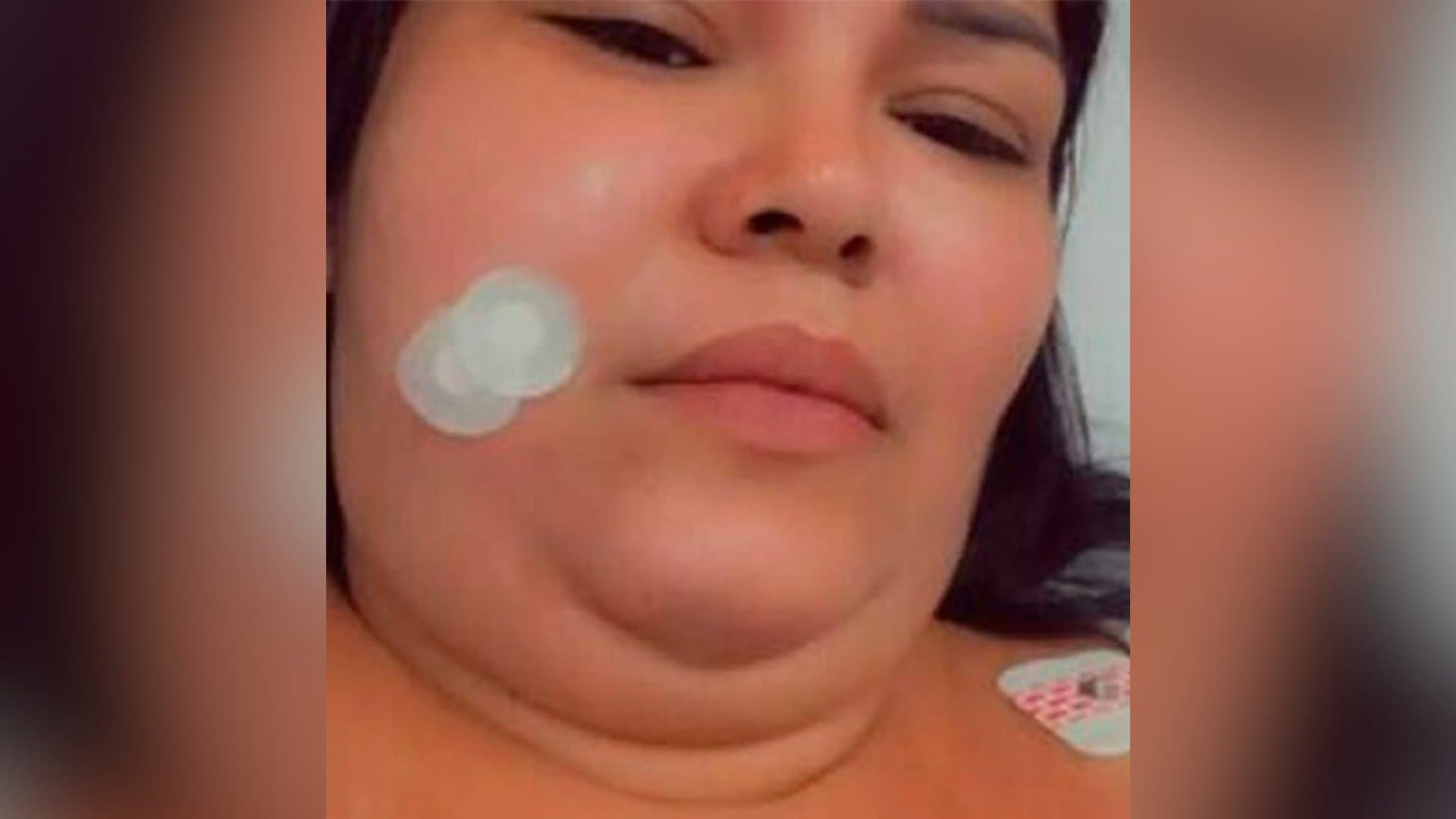 Moradora de Sidrolândia sofre com neuralgia do trigêmeo e pede ajuda para custear cirurgia de R$ 73,6 mil