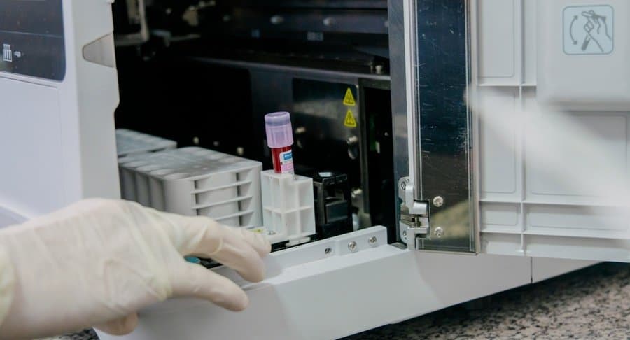 Exames laboratoriais somam mais de 95 mil procedimentos no primeiro semestre em Sidrolândia