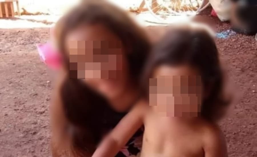 Meninas queimadas vão passar por nova cirurgia e vaquinha vai ajudar no tratamento após alta