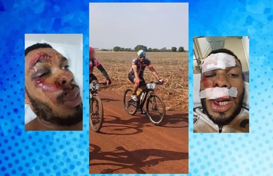 Amigos divulgam ‘vakinha’ para ajudar ciclista que sofreu acidente durante treino