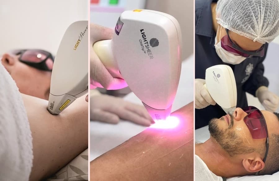 Gira Laser abre agenda de atendimento com depilação em Maracaju no dia 13