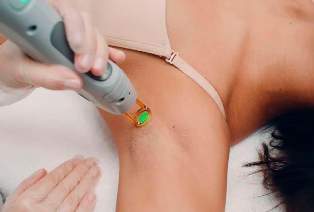 Spazen promove dia especial de depilação a laser neste sábado em Sidrolândia